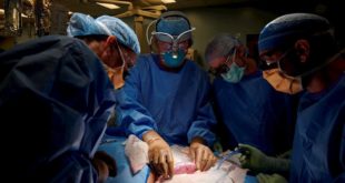 Avance de la ciencia: médicos trasplantan riñón de un cerdo a un humano