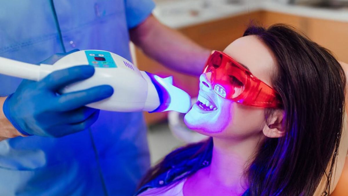 Teeth Whitening Unlocking the Secrets to a Dazzling Smile